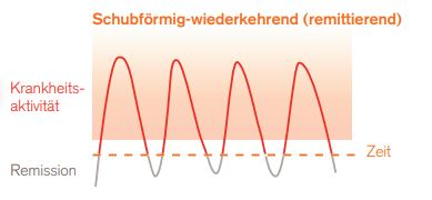 Lupus Grafik schubförmig-wiederkehrender Verlauf